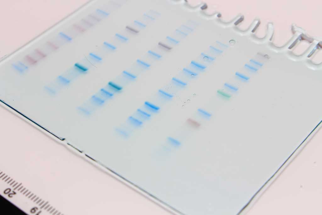  Precast Protein Gels 10 x 8cm, 12%, 12 Well