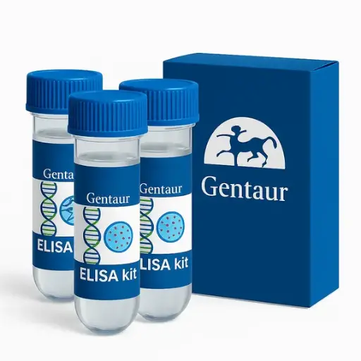 TruPoint Beta-Secretase Assay Kit384 - 